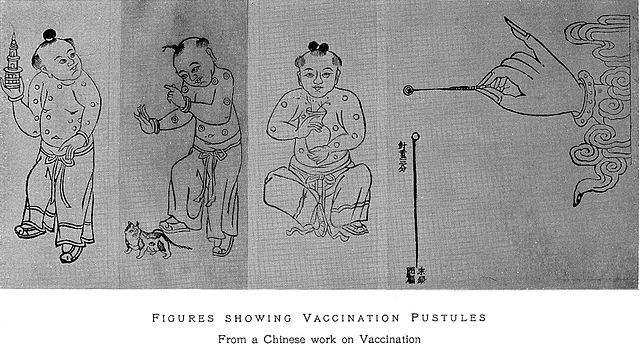File:Figures showing vaccination pustules. Wellcome L0017918.jpg. (2020, September 9). Wikimedia Commons, the free media repository. Retrieved 09:52, April 2, 2021 from https://commons.wikimedia.org/w/index.php?title=File:Figures_showing_vaccination_pustules._Wellcome_L0017918.jpg&oldid=453154188.